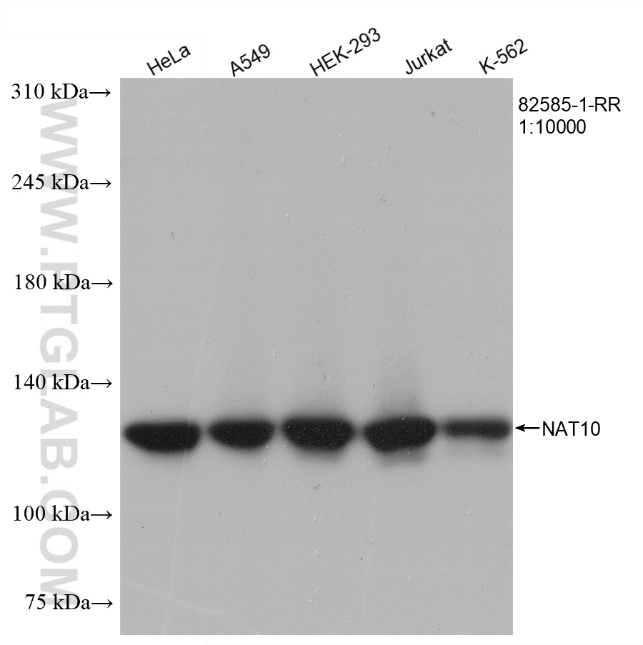 WB analysis using 82585-1-RR