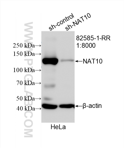 WB analysis of HeLa using 82585-1-RR (same clone as 82585-1-PBS)