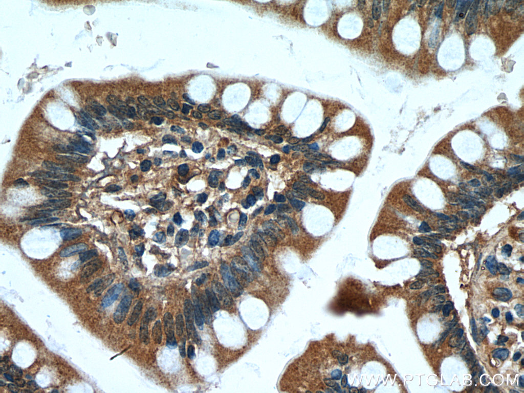 IHC staining of human small intestine using 11410-1-AP