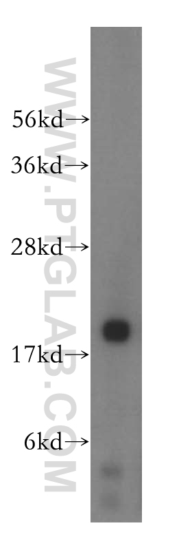 WB analysis of HeLa using 15807-1-AP