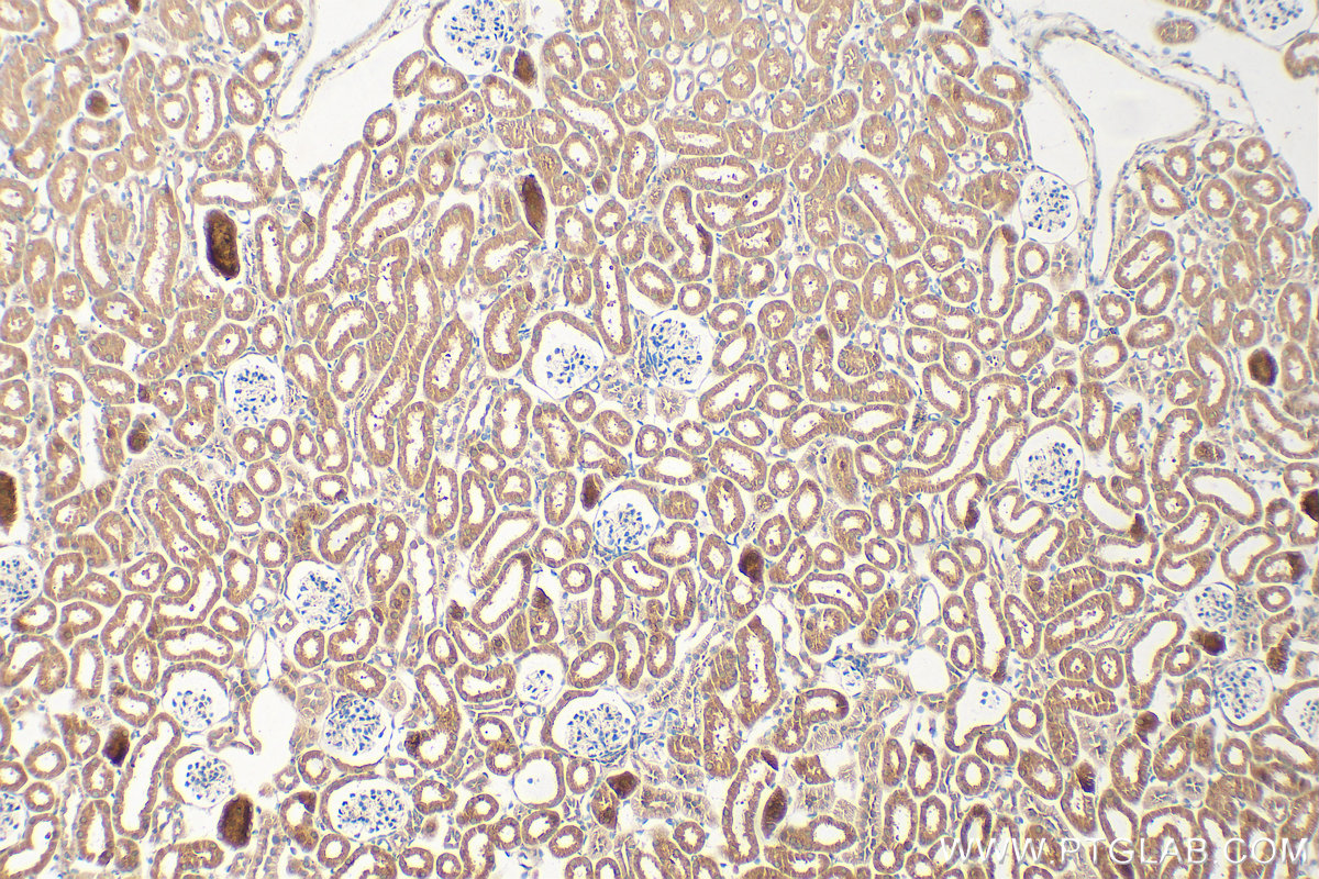IHC staining of mouse kidney using 10908-1-AP
