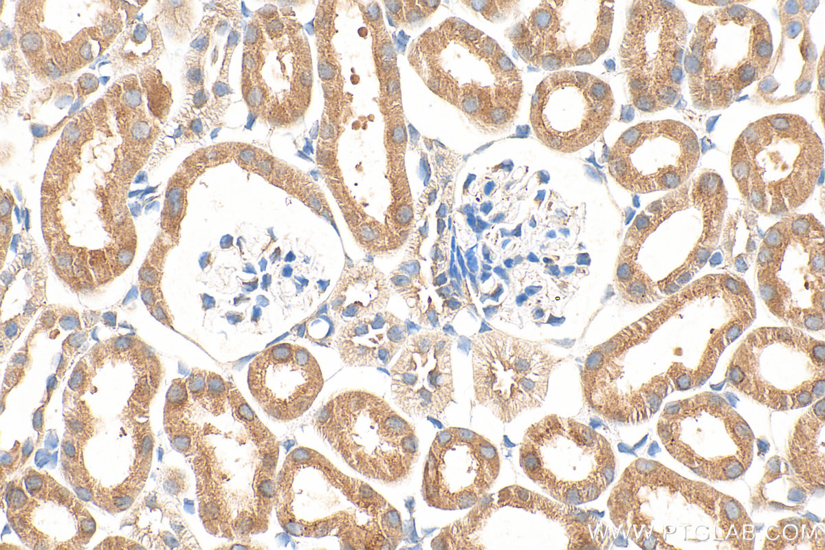 IHC staining of mouse kidney using 10908-1-AP