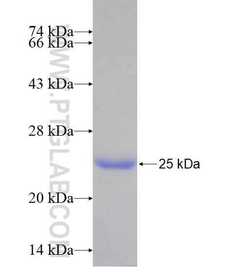 NAV1 fusion protein Ag14964 SDS-PAGE NAV1 fusion protein Ag14964 SDS-PAGE