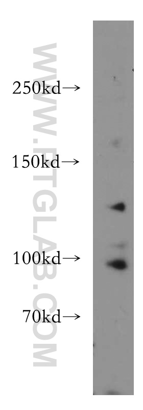 WB analysis of HEK-293 using 11875-1-AP