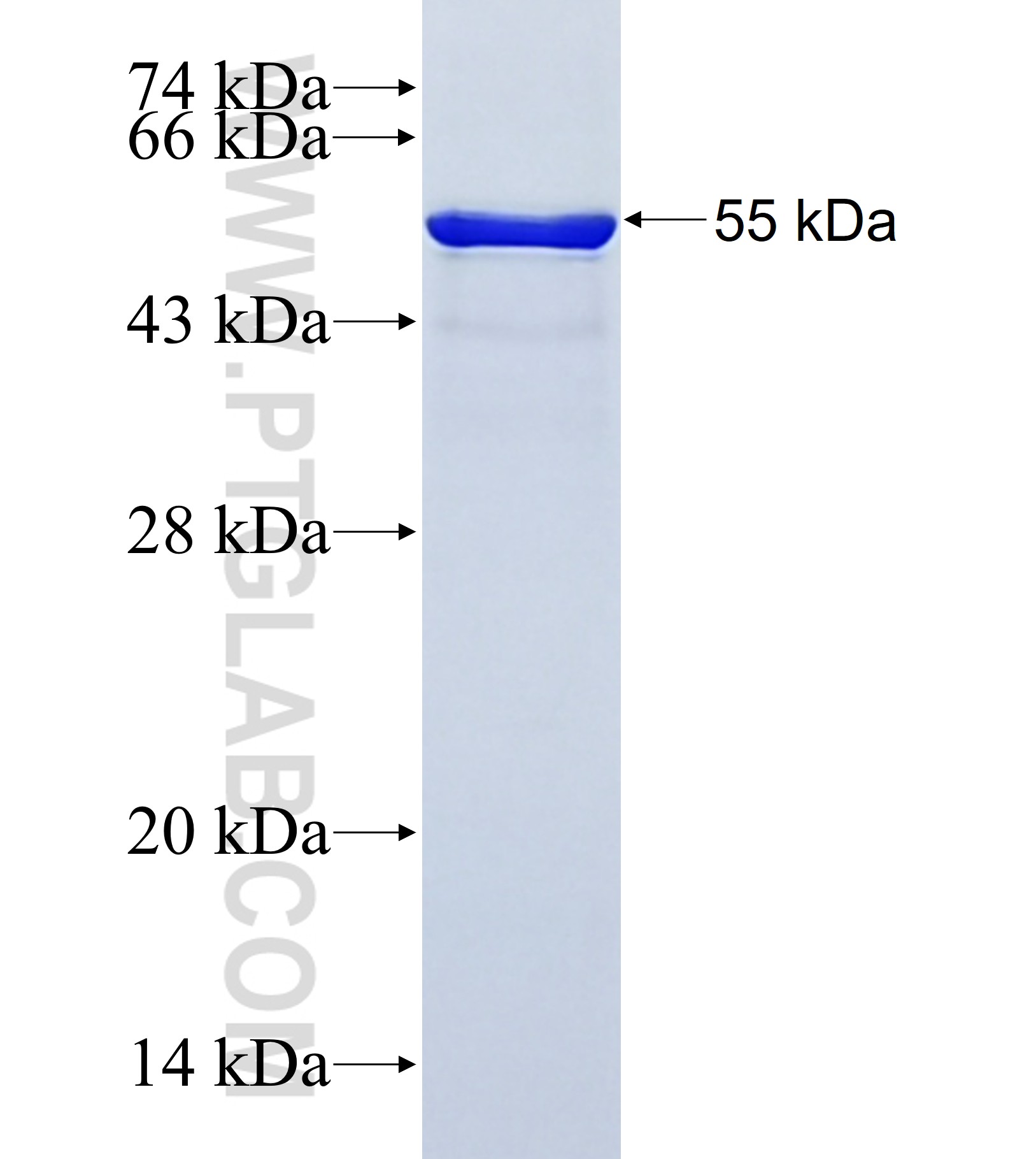 NAV3 fusion protein Ag41576 SDS-PAGE