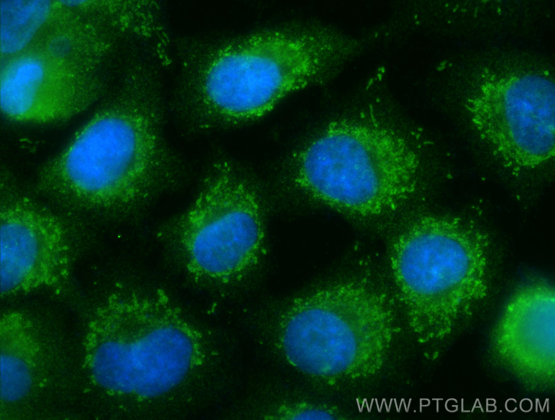 IF Staining of A549 using 32022-1-AP