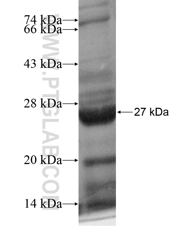 NB-3 fusion protein Ag17412 SDS-PAGE NB-3 fusion protein Ag17412 SDS-PAGE