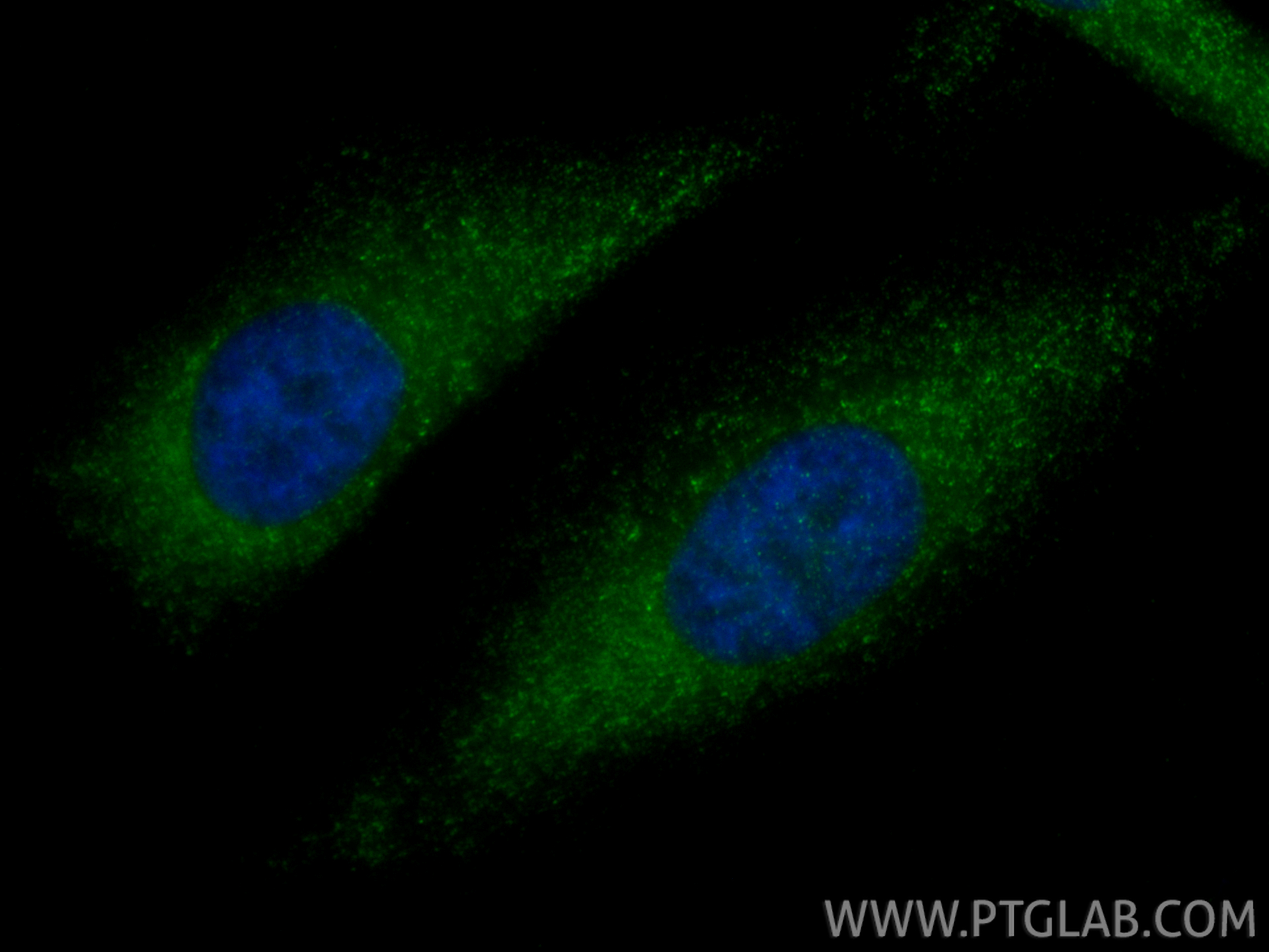 IF Staining of HeLa using 12069-1-AP