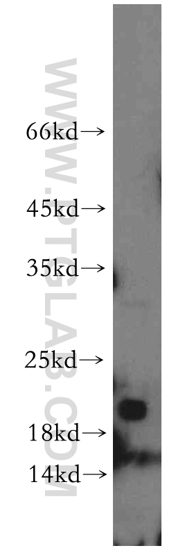 WB analysis of mouse colon using 12069-1-AP