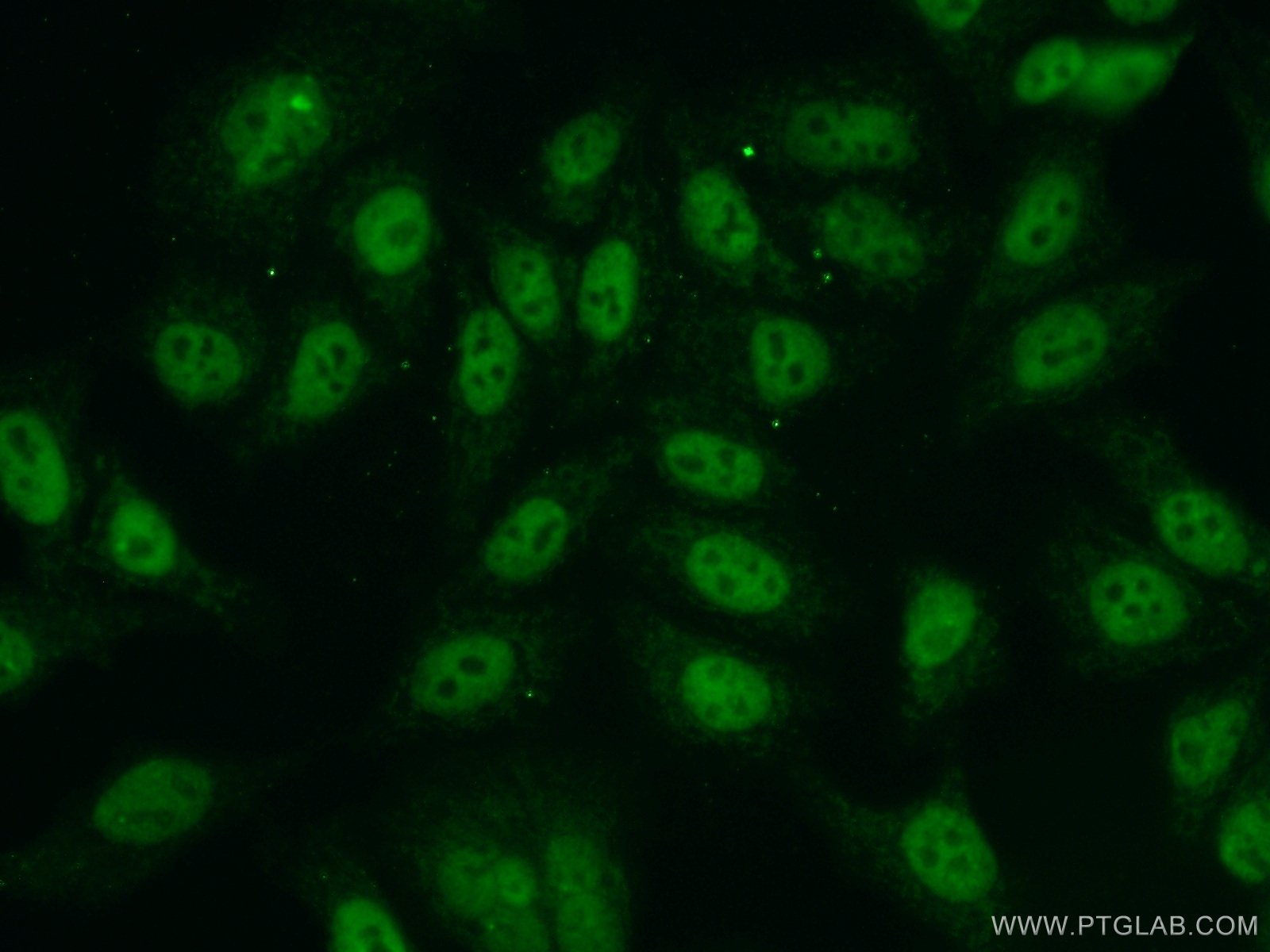 NBN / NBS1 Polyclonal antibody