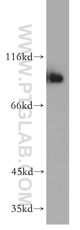 WB analysis of HeLa using 55025-1-AP