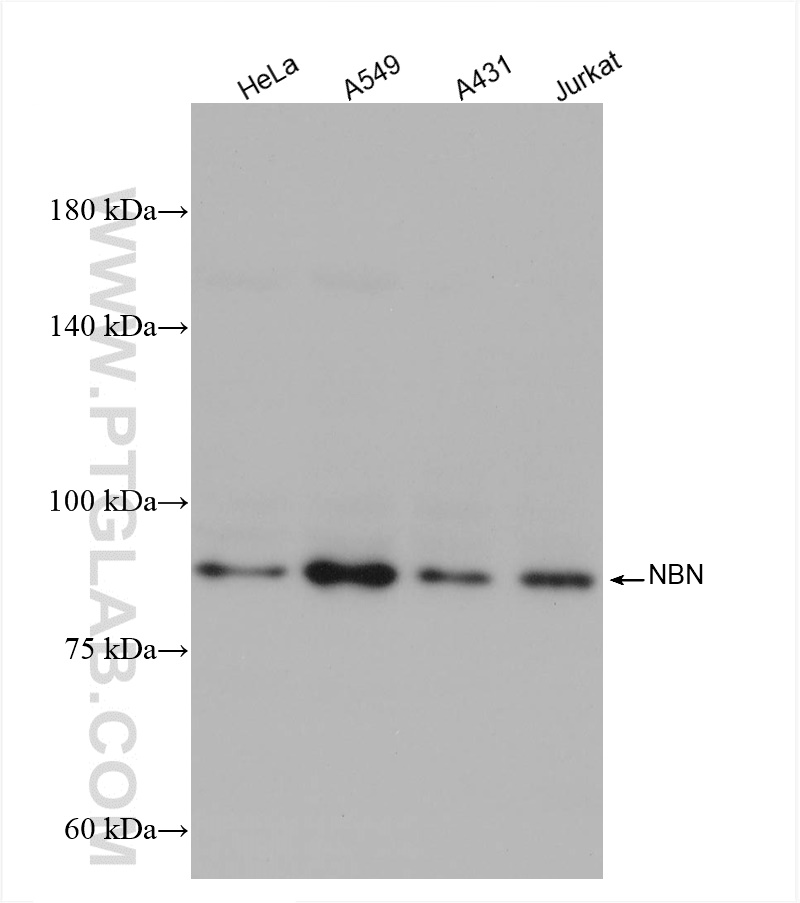 WB analysis using 82884-1-RR