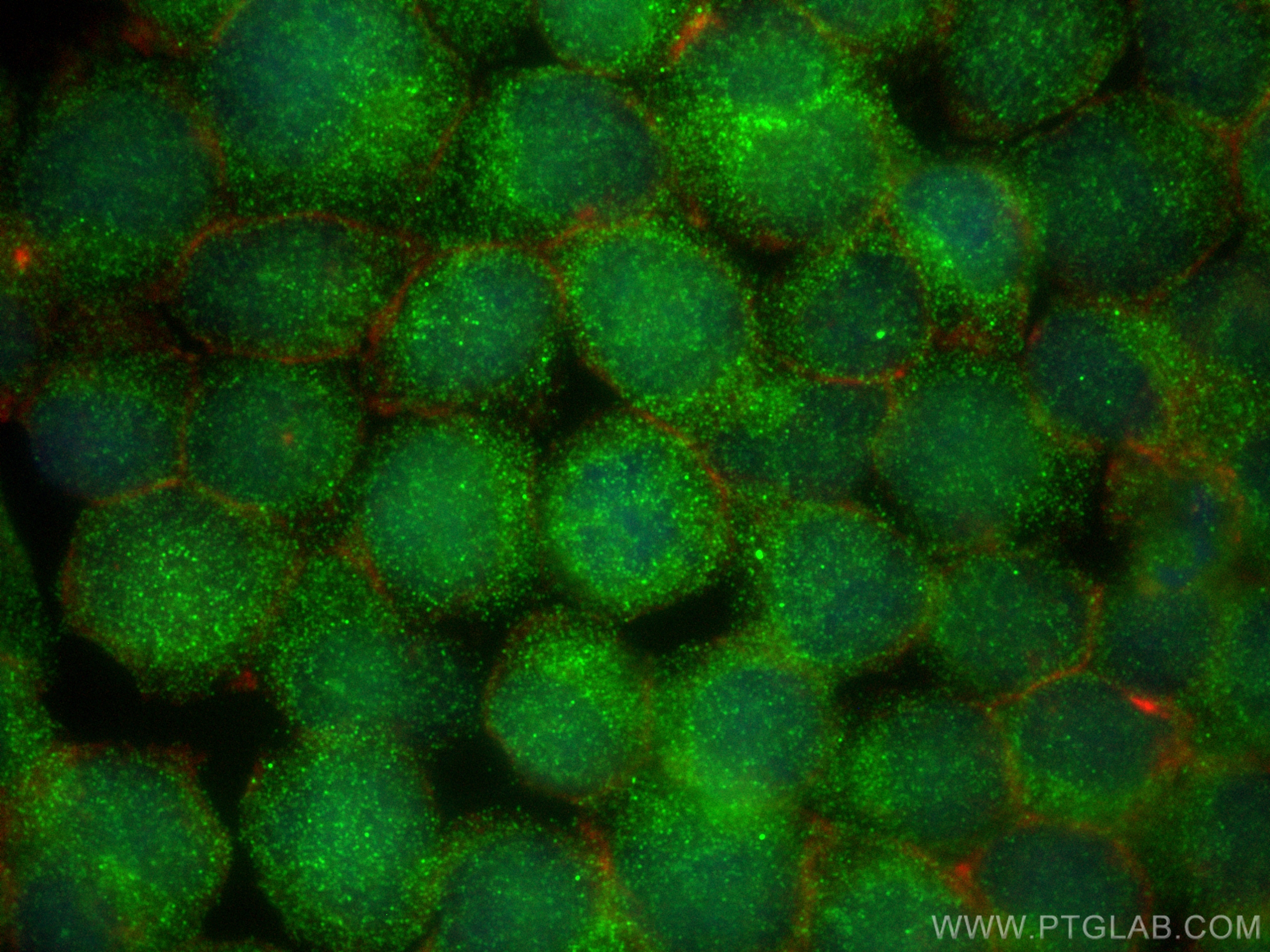 IF Staining of Jurkat using 13242-1-AP