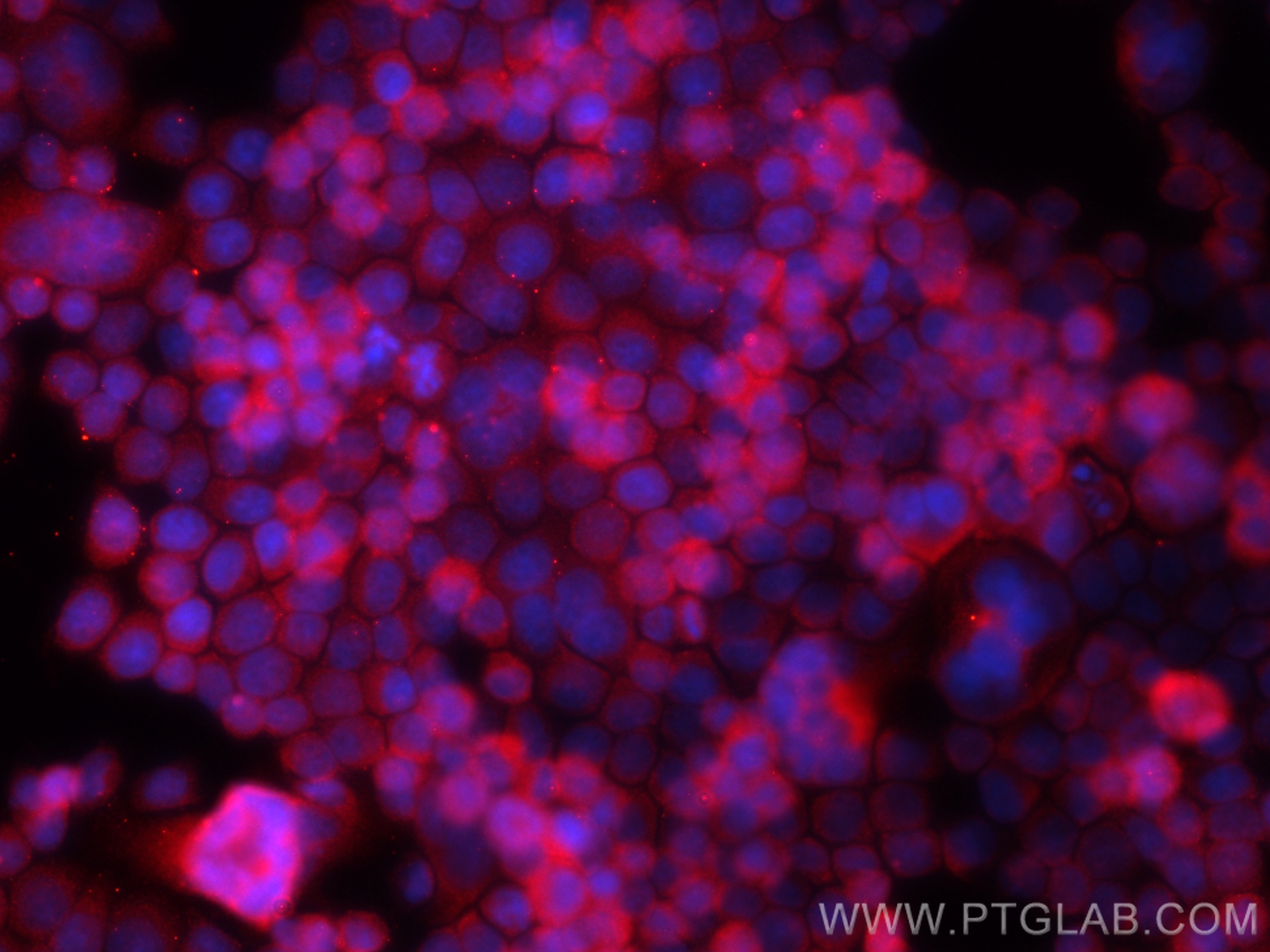 IF Staining of BxPC-3 using 13242-1-AP