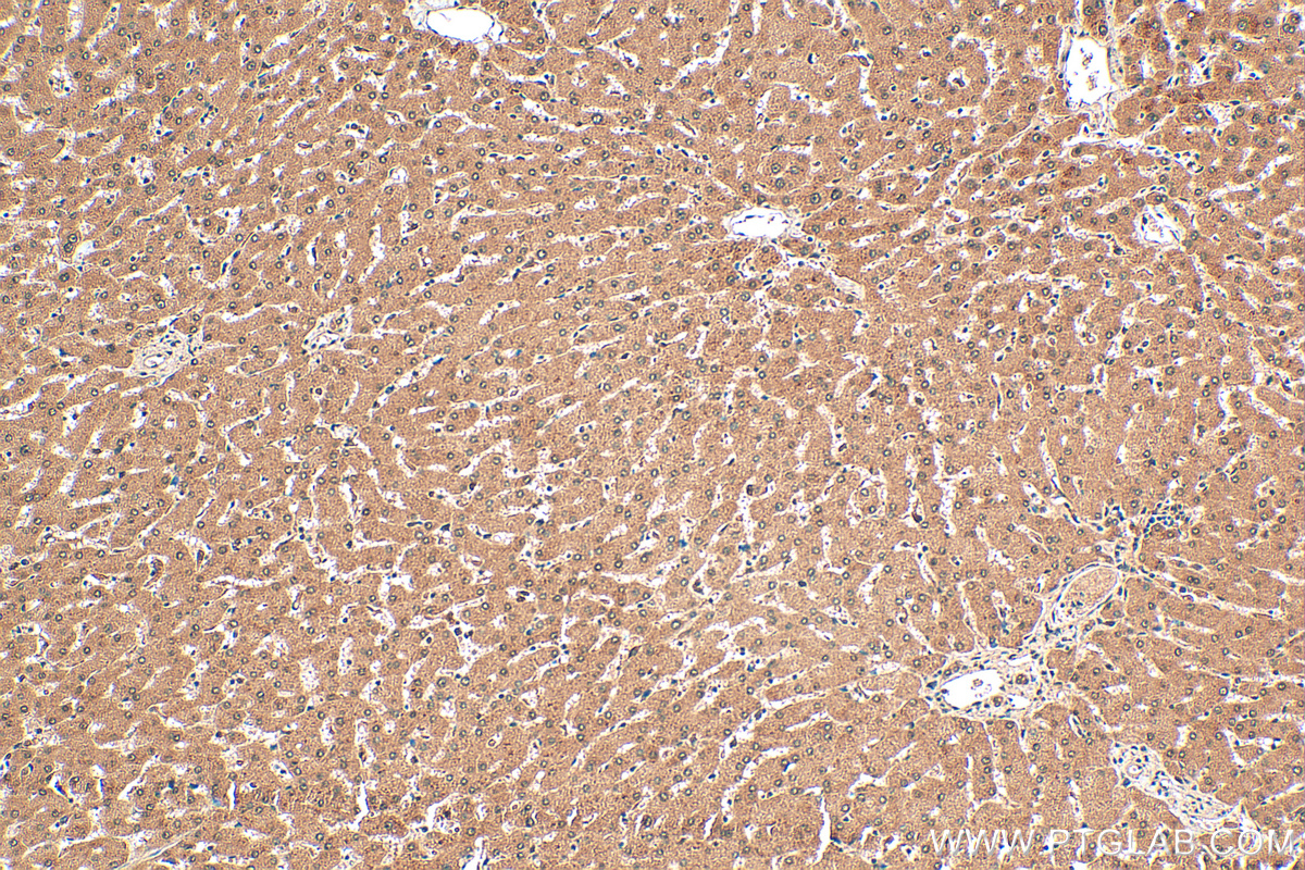 IHC staining of human liver using 13242-1-AP