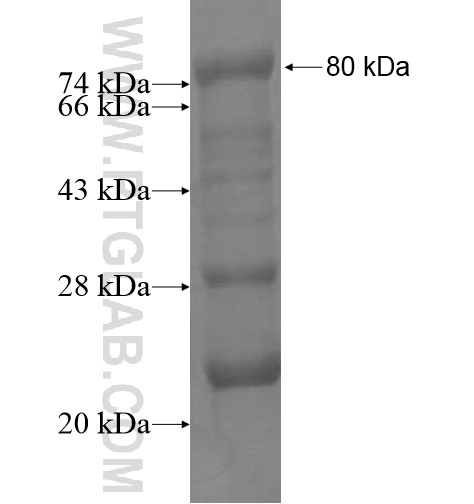 NBPF22P fusion protein Ag11516 SDS-PAGE NBPF22P fusion protein Ag11516 SDS-PAGE