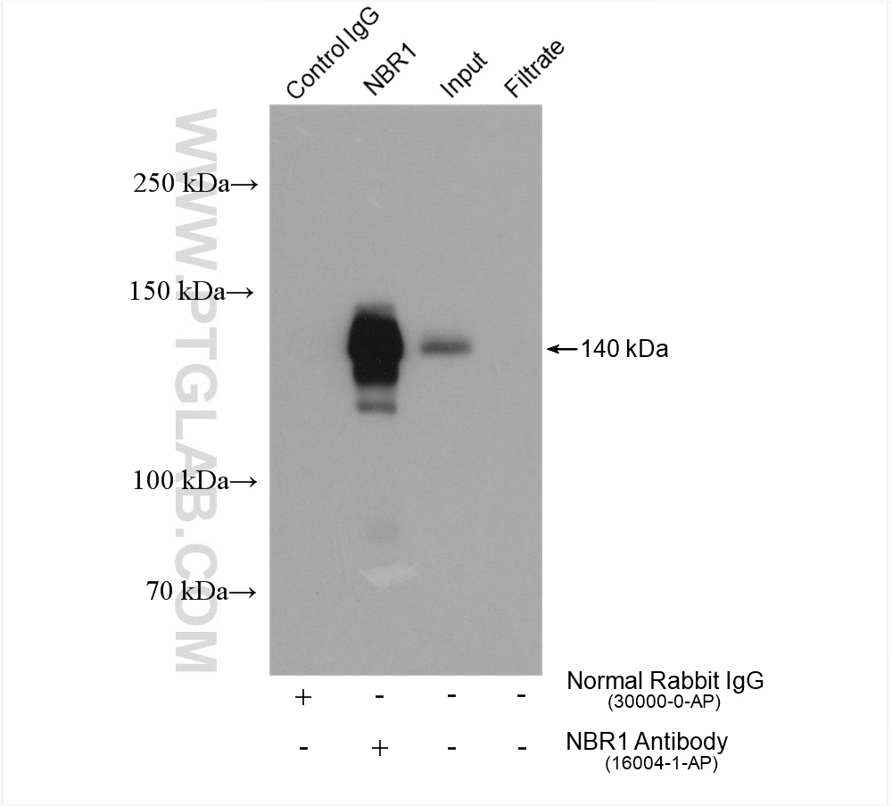 IP experiment of HeLa using 16004-1-AP