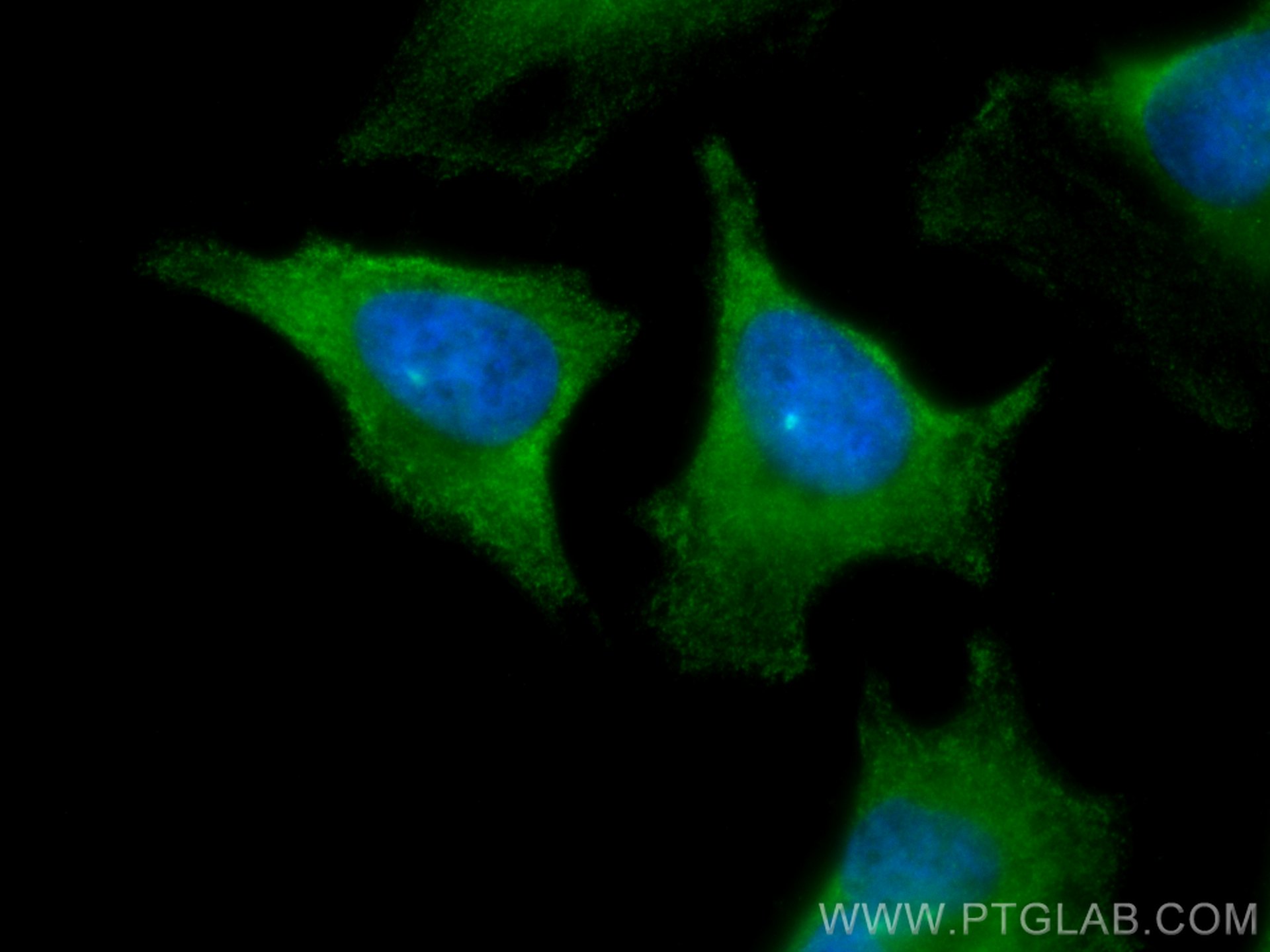 IF Staining of HeLa using CL488-16004