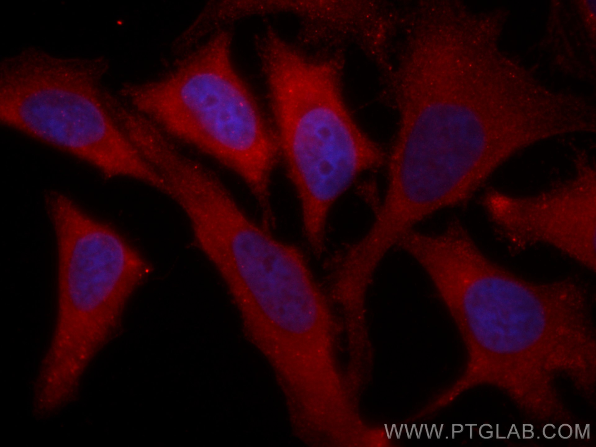 IF Staining of HeLa using CL594-16004