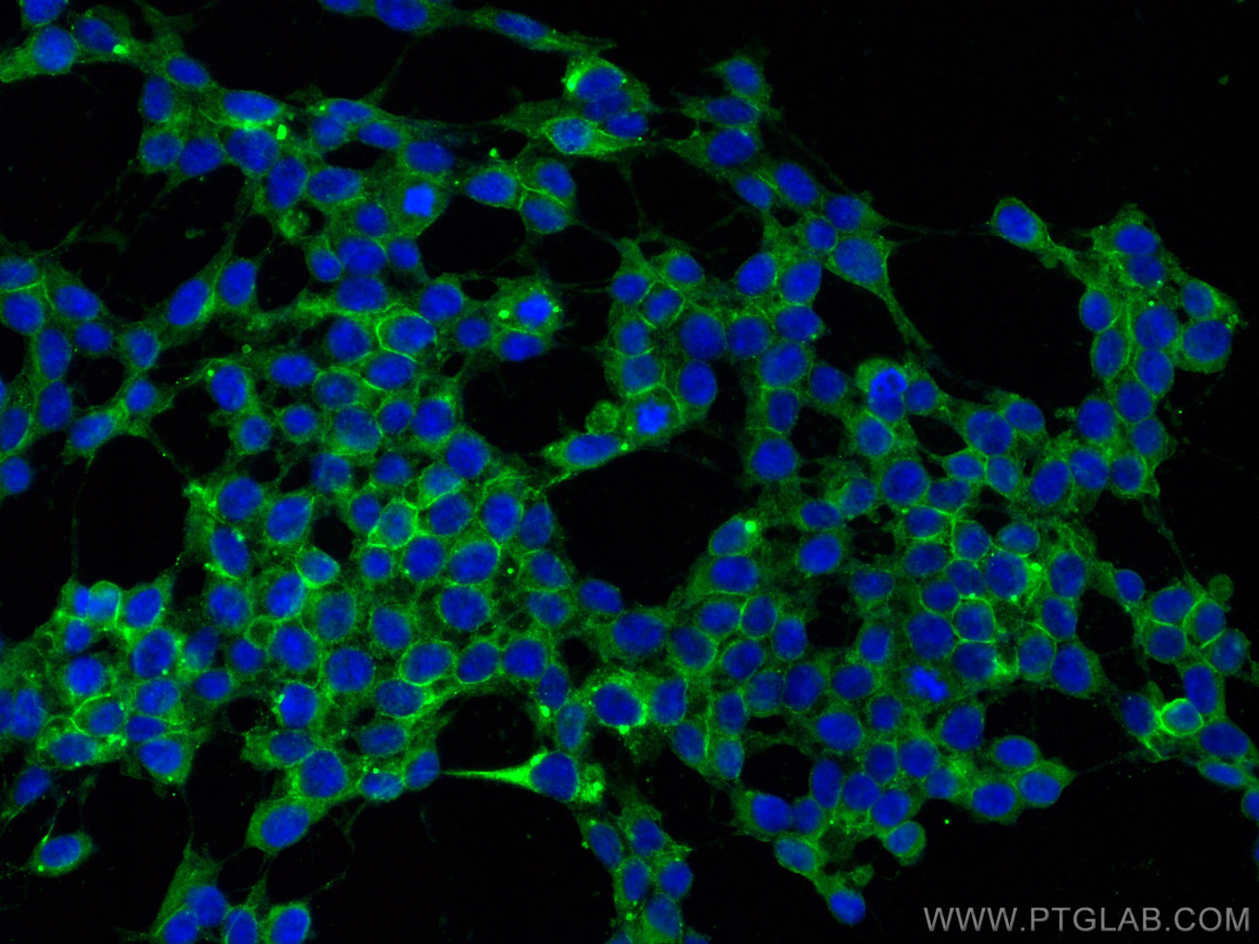 IF Staining of SH-SY5Y using 14255-1-AP