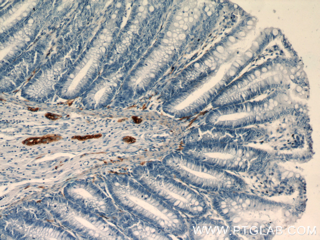 NCAM1/CD56 Polyclonal antibody