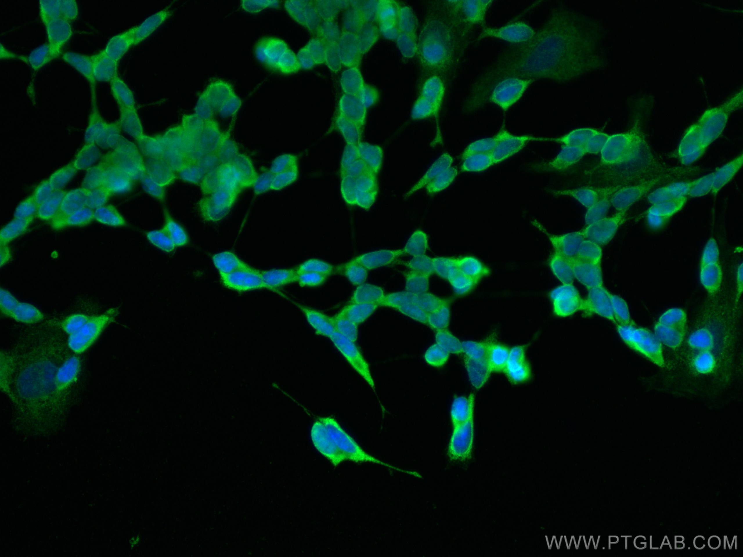 IF Staining of SH-SY5Y using 60238-1-Ig