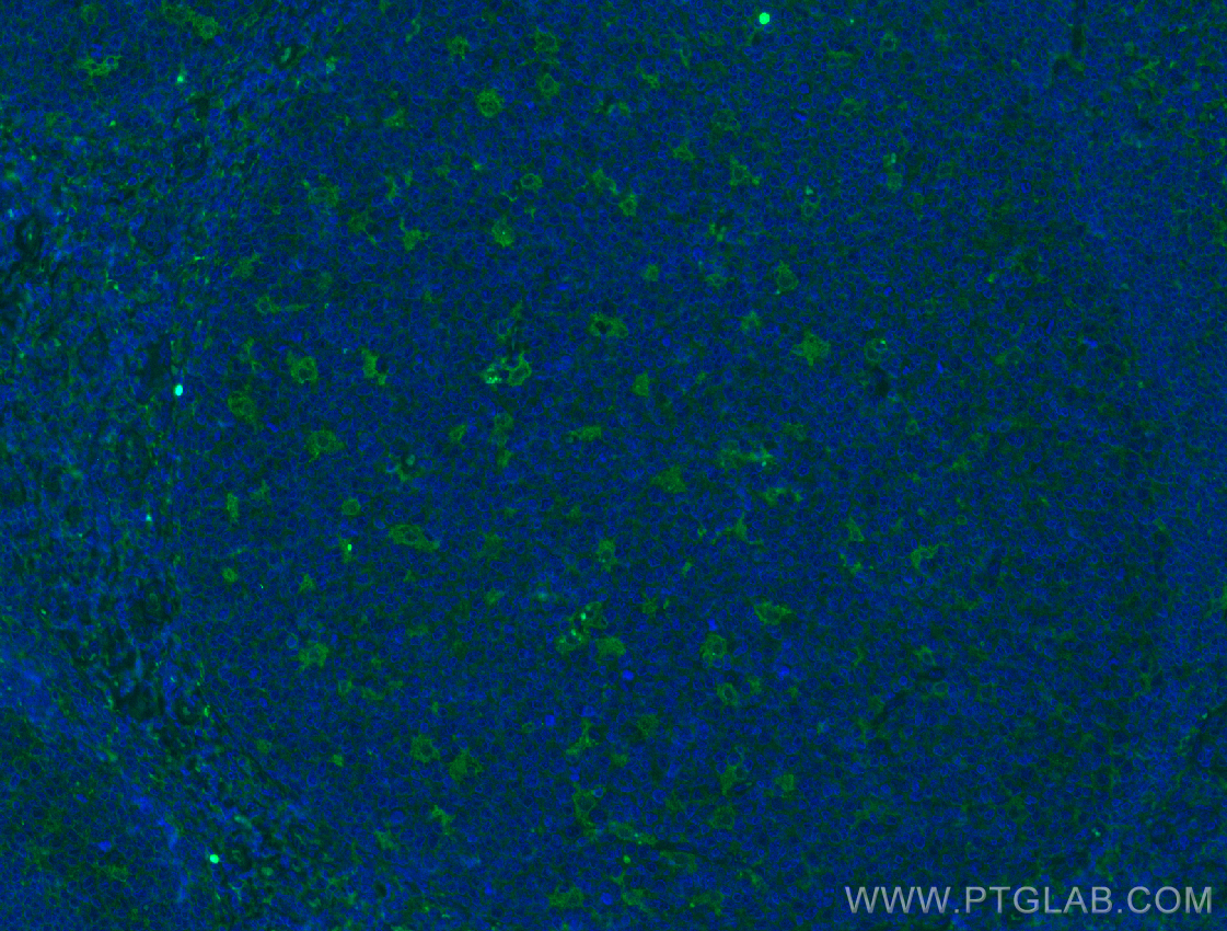 IF Staining of human tonsillitis using 60238-1-Ig