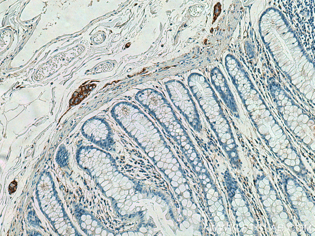IHC staining of human colon using 60238-1-Ig