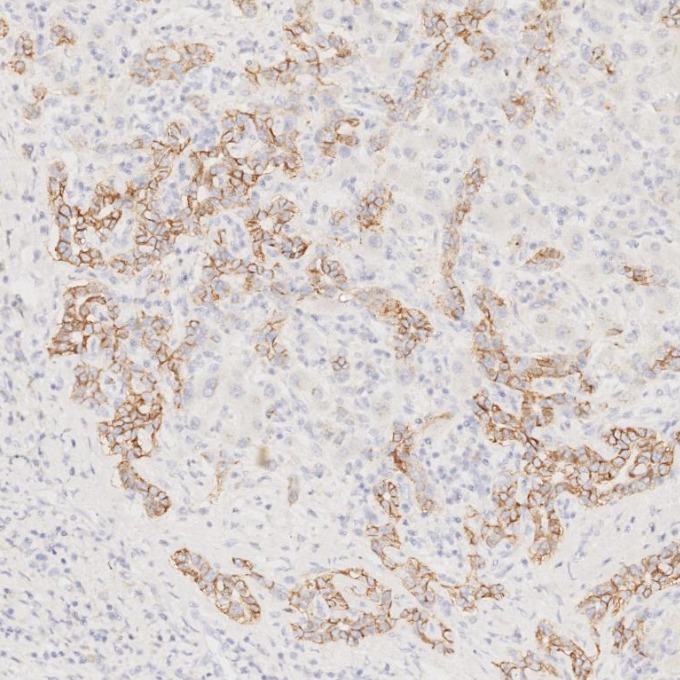 IHC staining of human liver using 60238-1-Ig