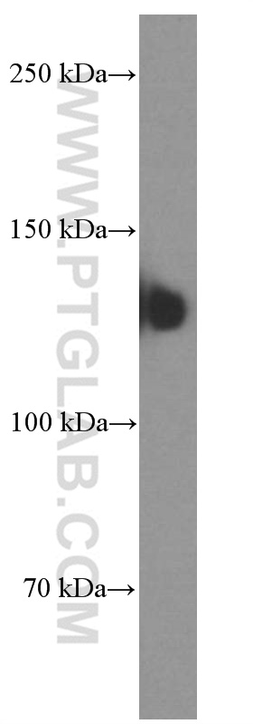 WB analysis of fetal human brain using 60238-1-Ig (same clone as 60238-1-PBS)