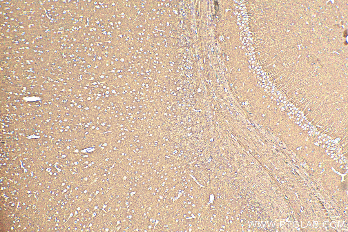 IHC staining of mouse brain using 82715-1-RR