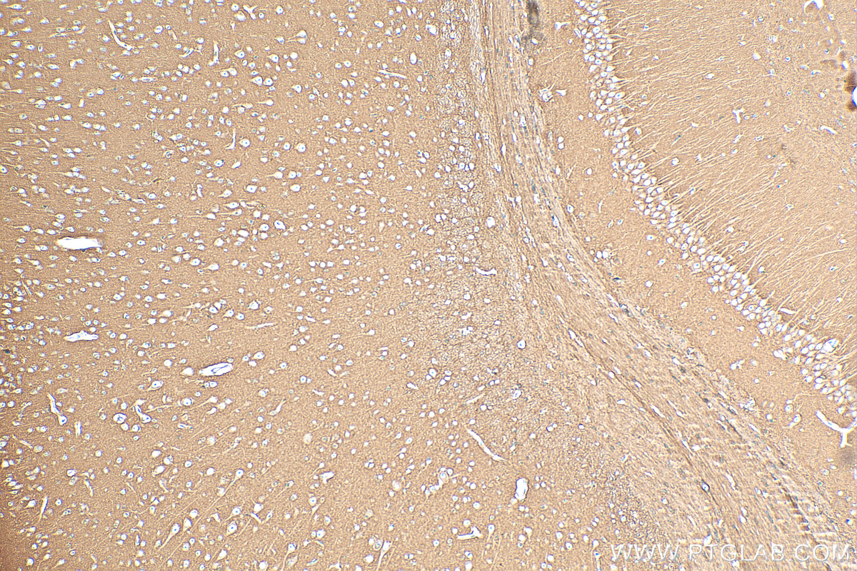 IHC staining of mouse brain using 82715-1-RR