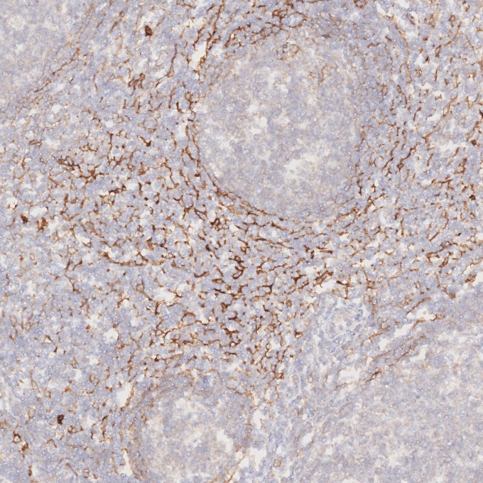 IHC staining of human tonsillitis using 82715-1-RR IHC staining of human tonsillitis using 82715-1-RR