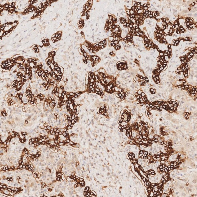 IHC staining of human liver using 82715-1-RR IHC staining of human liver using 82715-1-RR
