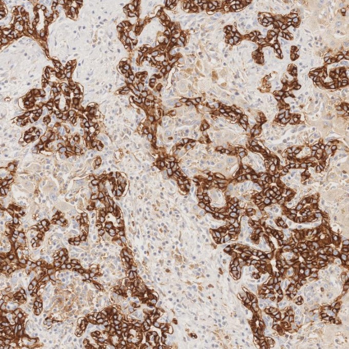 IHC staining of human liver using 82715-1-RR IHC staining of human liver using 82715-1-RR
