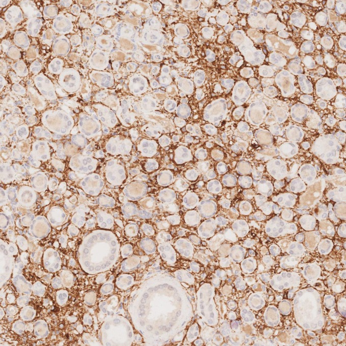 IHC staining of human kidney using 82715-1-RR IHC staining of human kidney using 82715-1-RR