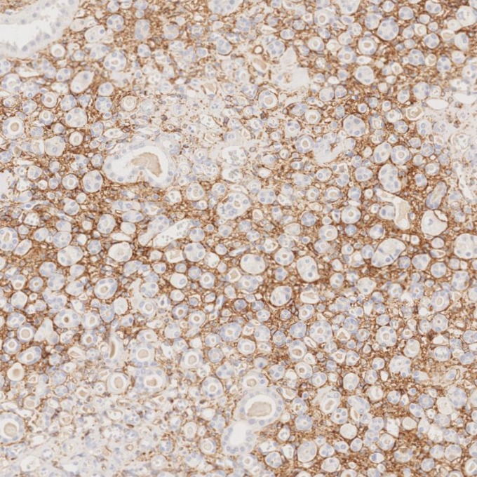 IHC staining of human kidney using 82715-1-RR IHC staining of human kidney using 82715-1-RR