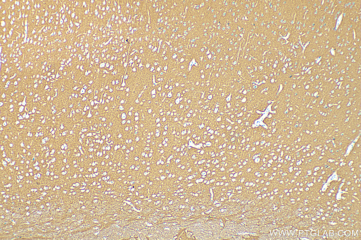 IHC staining of mouse brain using 31536-1-AP