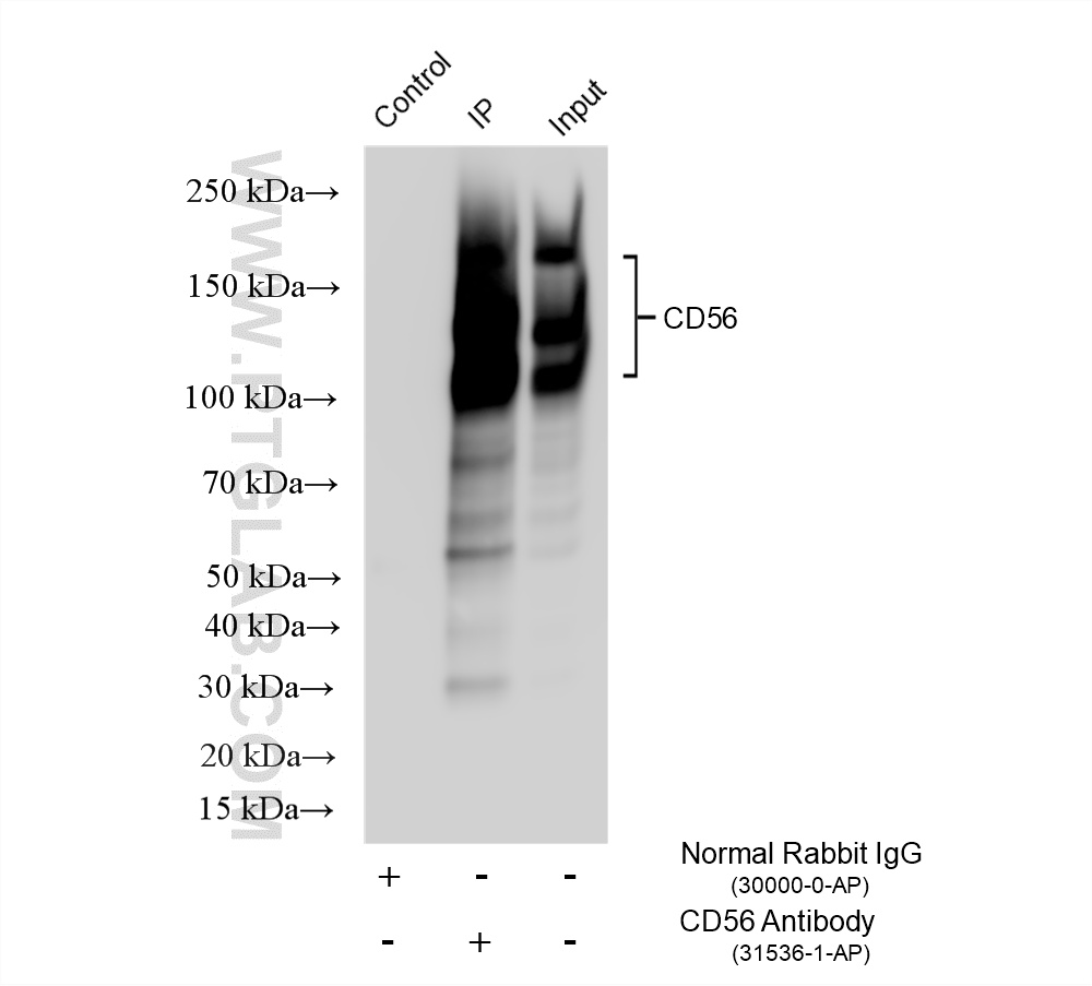 IP experiment of mouse brain using 31536-1-AP