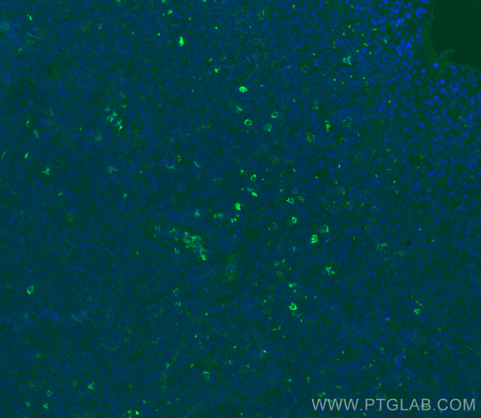 IF Staining of human tonsillitis using 82715-3-RR (same clone as 82715-3-PBS)