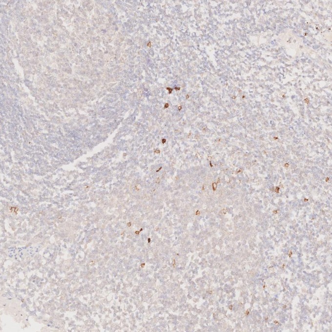 IHC staining of human tonsillitis using 82715-3-RR IHC staining of human tonsillitis using 82715-3-RR