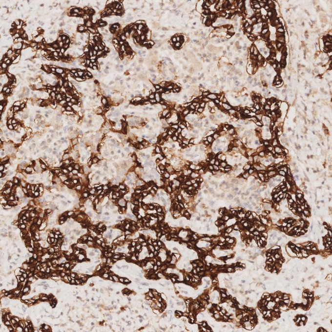 IHC staining of human liver using 82715-3-RR IHC staining of human liver using 82715-3-RR