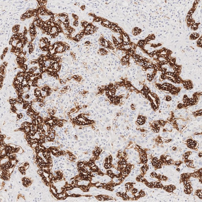 IHC staining of human liver using 82715-3-RR IHC staining of human liver using 82715-3-RR