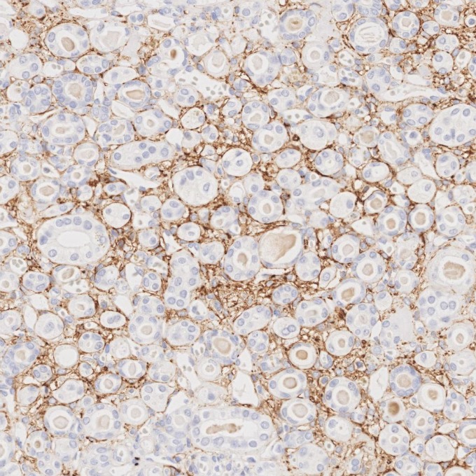 IHC staining of human kidney using 82715-3-RR IHC staining of human kidney using 82715-3-RR