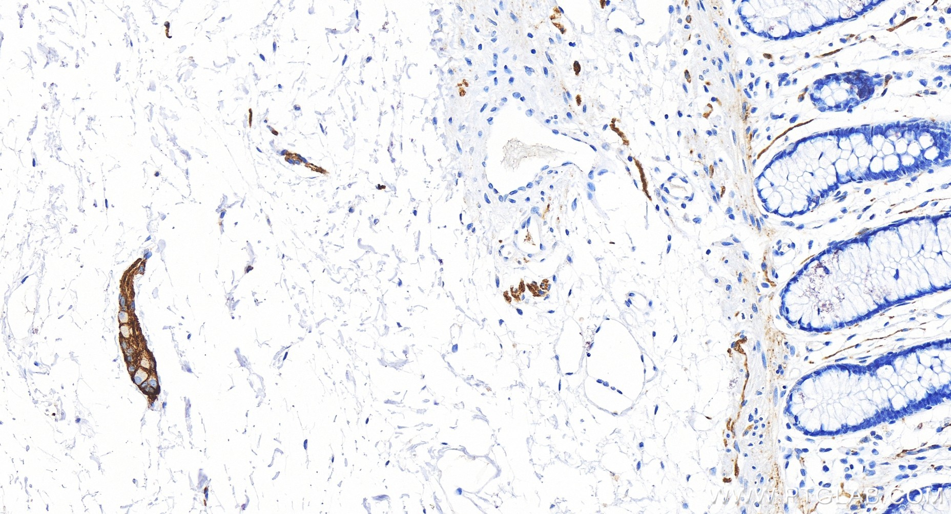 IHC staining of human colon using 83365-6-RR (same clone as 83365-6-PBS)