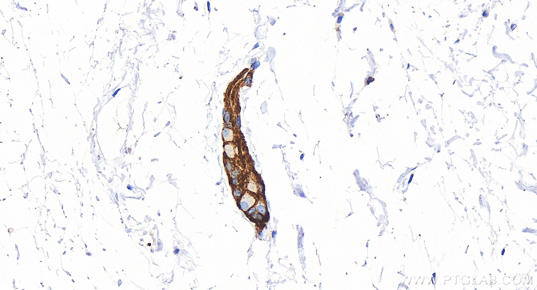 IHC staining of human colon using 83365-6-RR (same clone as 83365-6-PBS)
