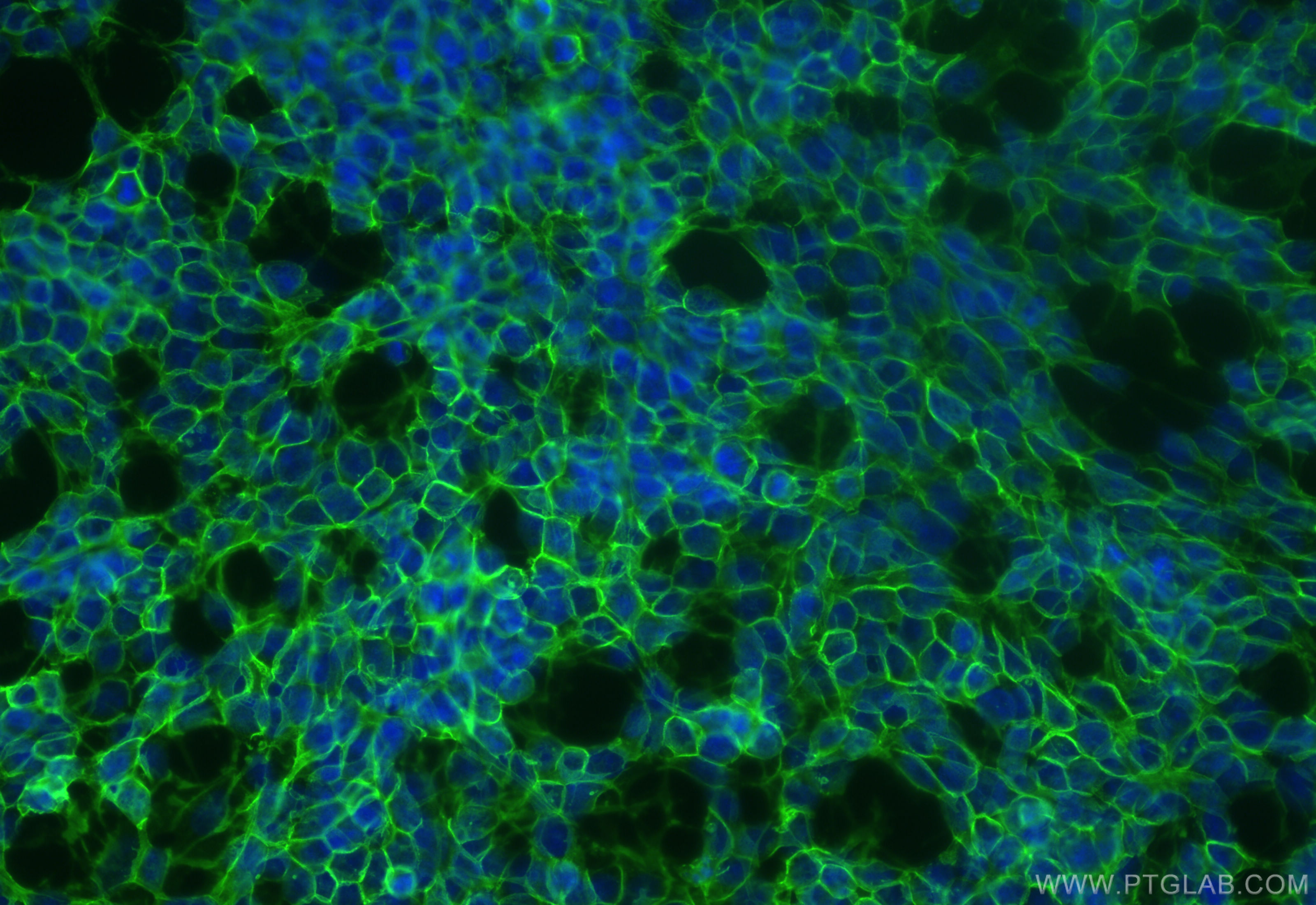 IF Staining of SH-SY5Y using 83365-6-RR (same clone as 83365-6-PBS)