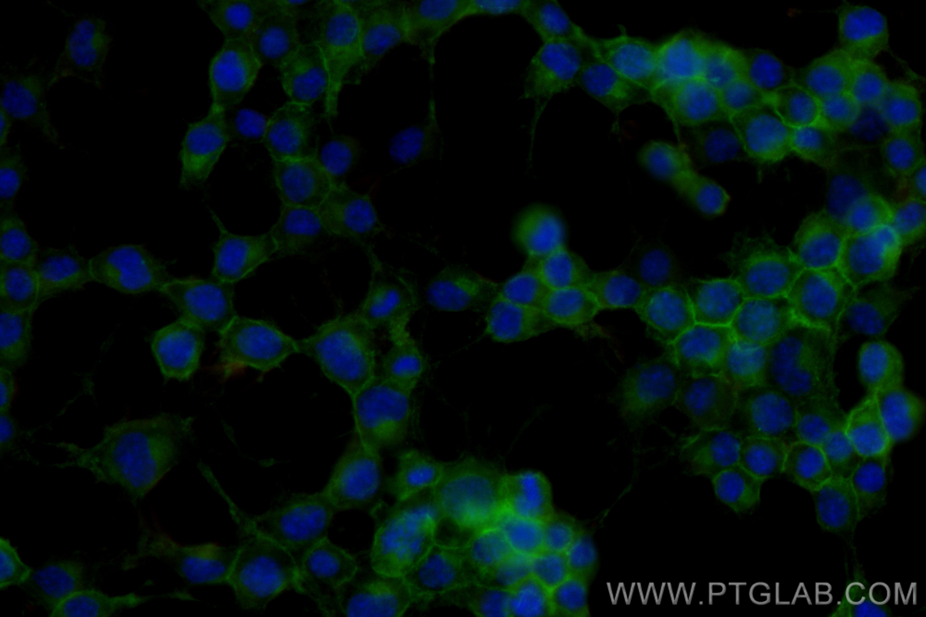 IF Staining of Neuro-2a using CL488-83883-5