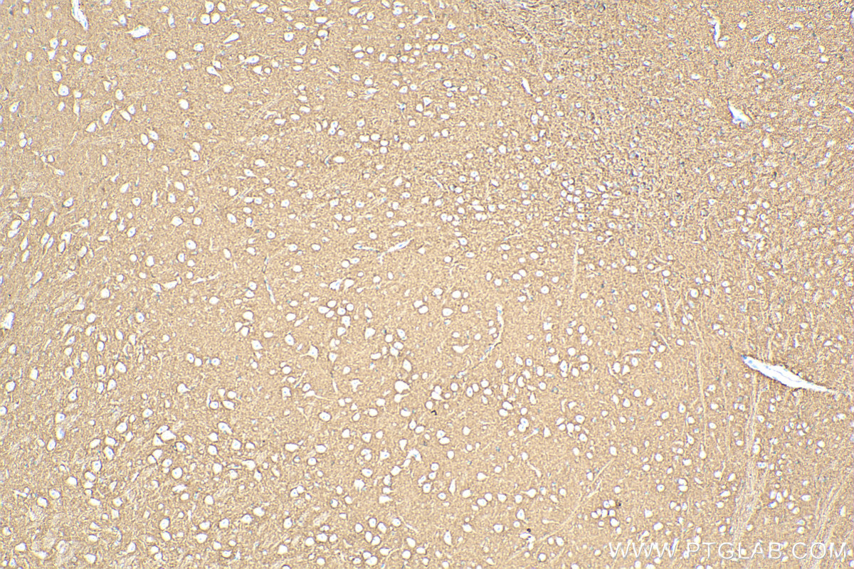 IHC staining of mouse brain using 13850-1-AP