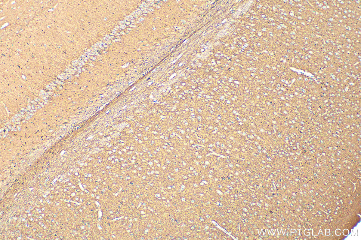 IHC staining of mouse brain using 13850-1-AP